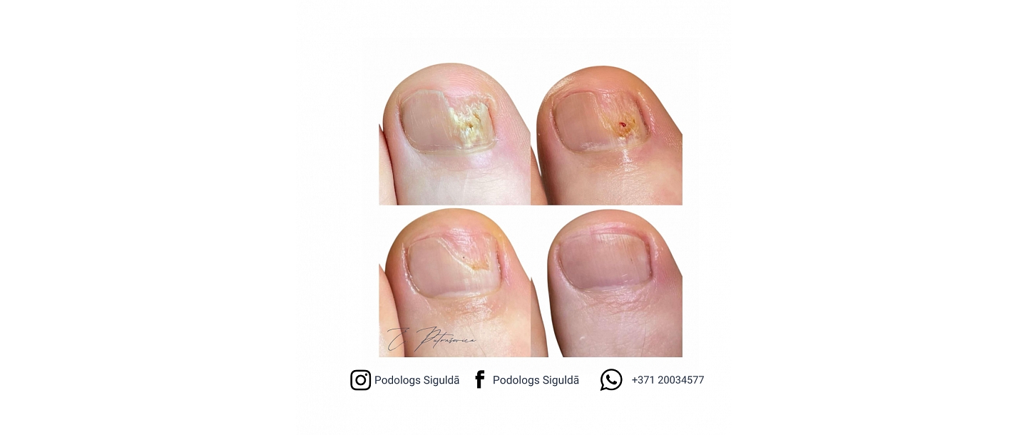 Putraševica Elīna - Podiatrist practice 