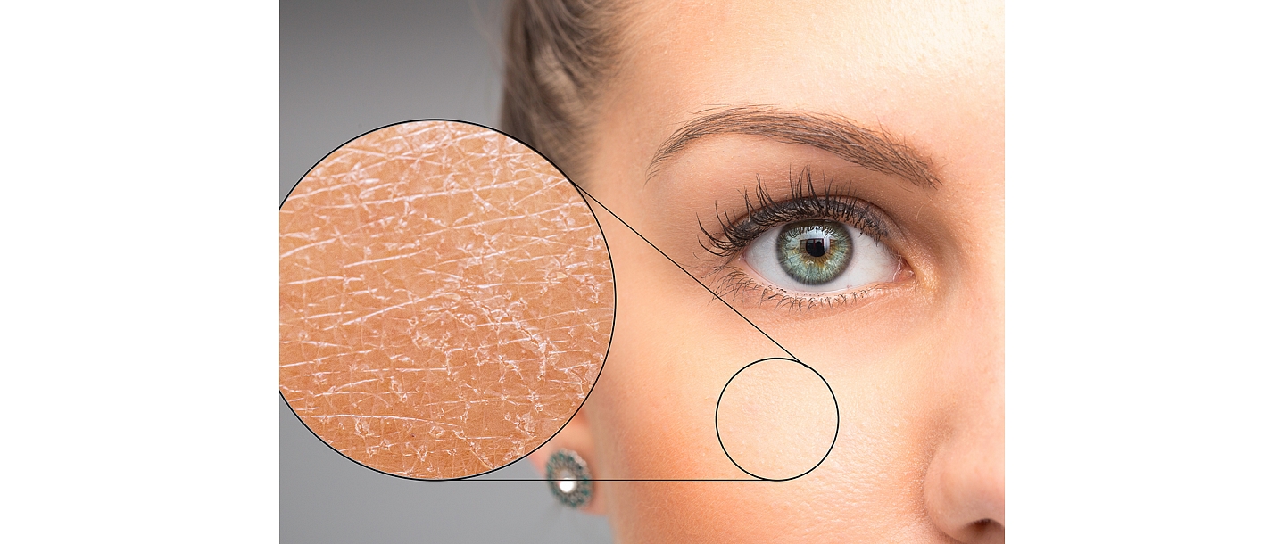 Skin disease treatment