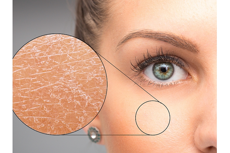 Skin disease treatment