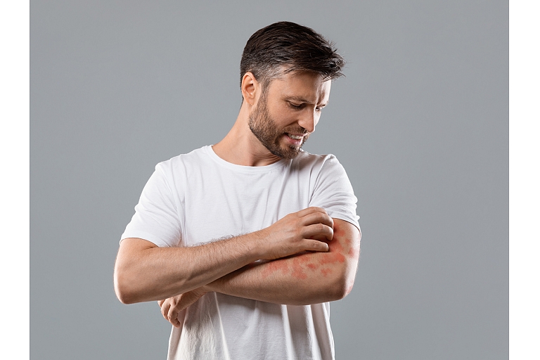 Veic ādas slimību diagnostiku