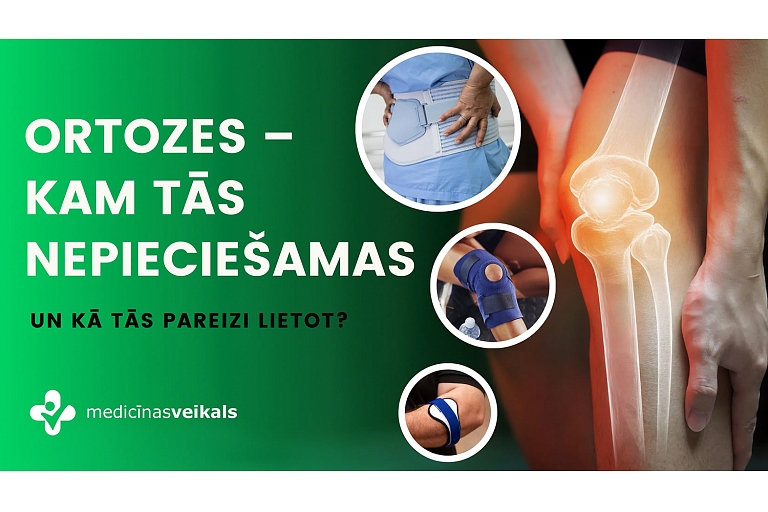 ortozes