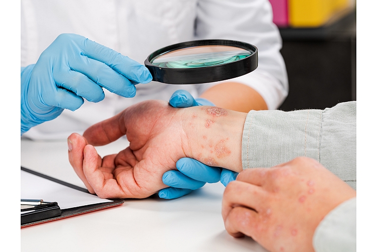 Veic sarežģītu ādas slimību diagnostiku