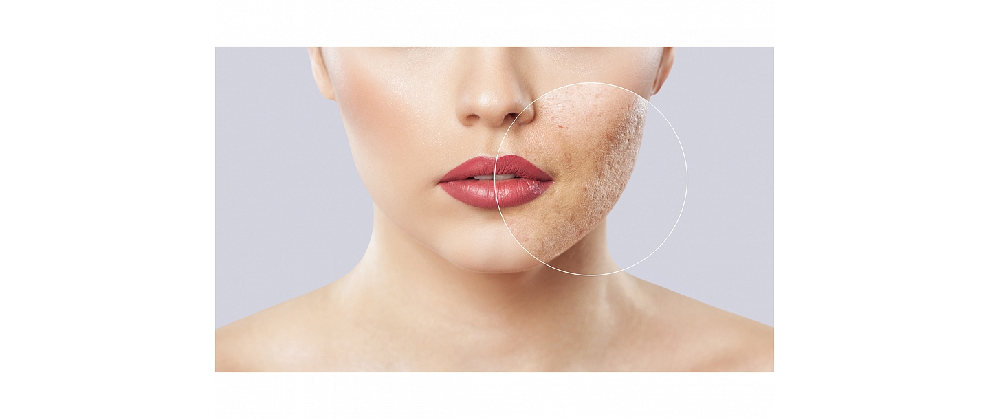 Veic dermatoskopiju