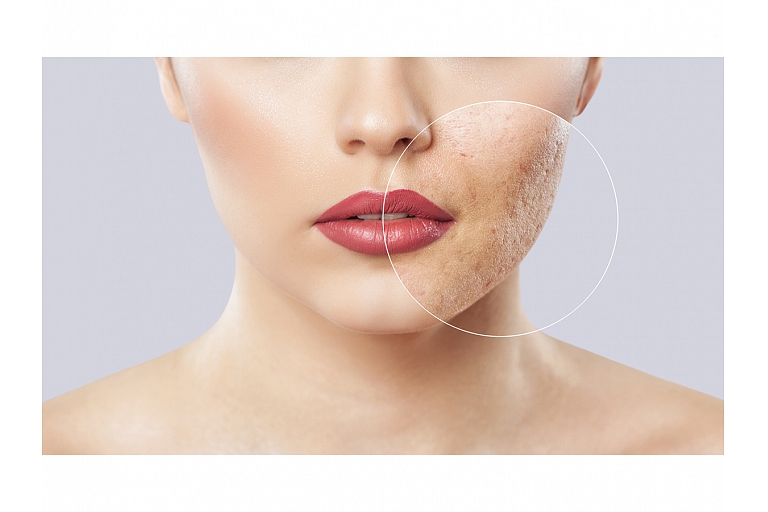 Veic dermatoskopiju