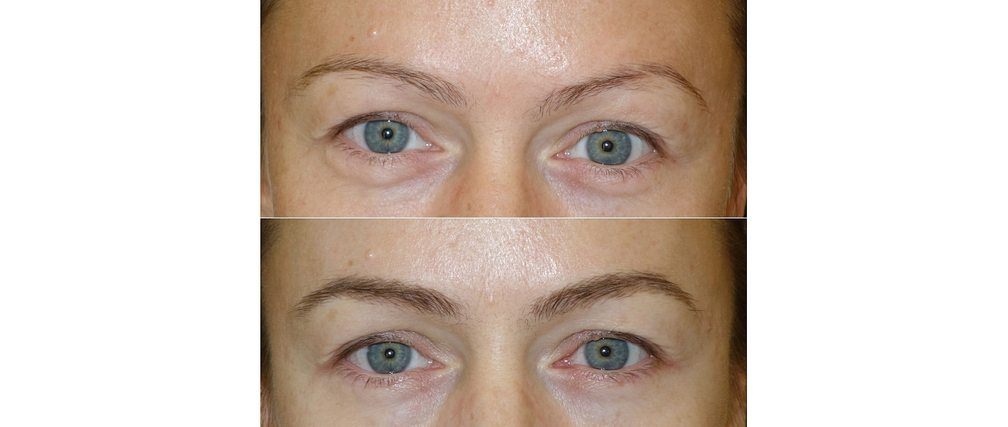 Micropigmentation center