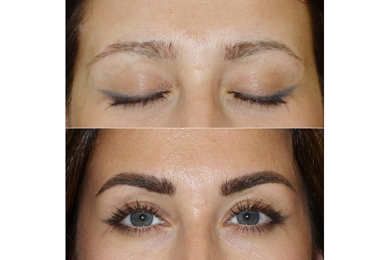 Mikropigmentācijas centrs