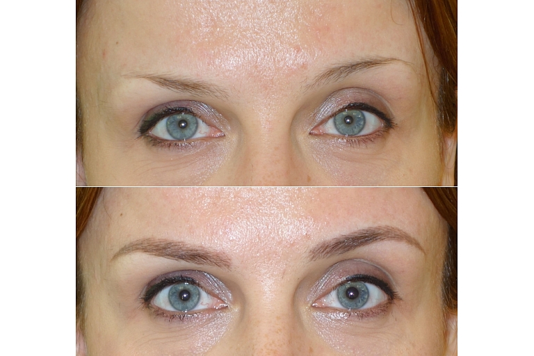 Mikropigmentācijas centrs