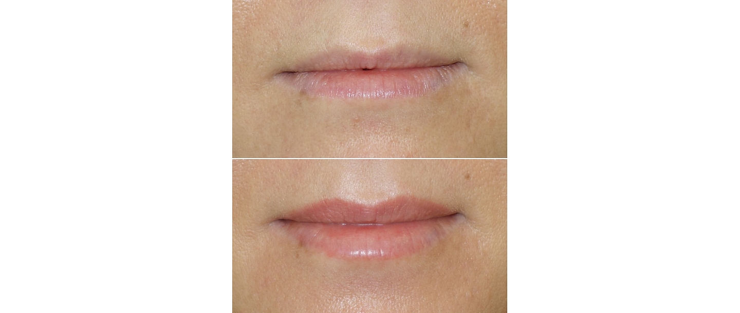 Micropigmentation center
