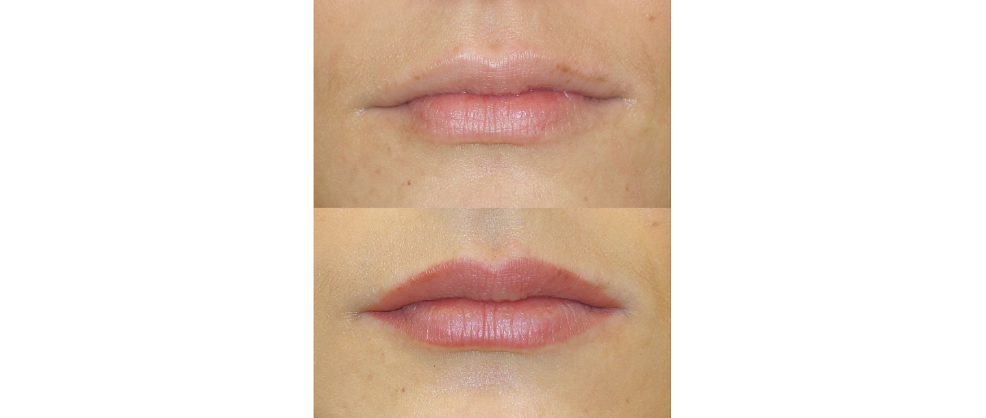 Micropigmentation center