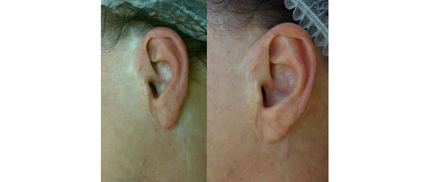 Micropigmentation center