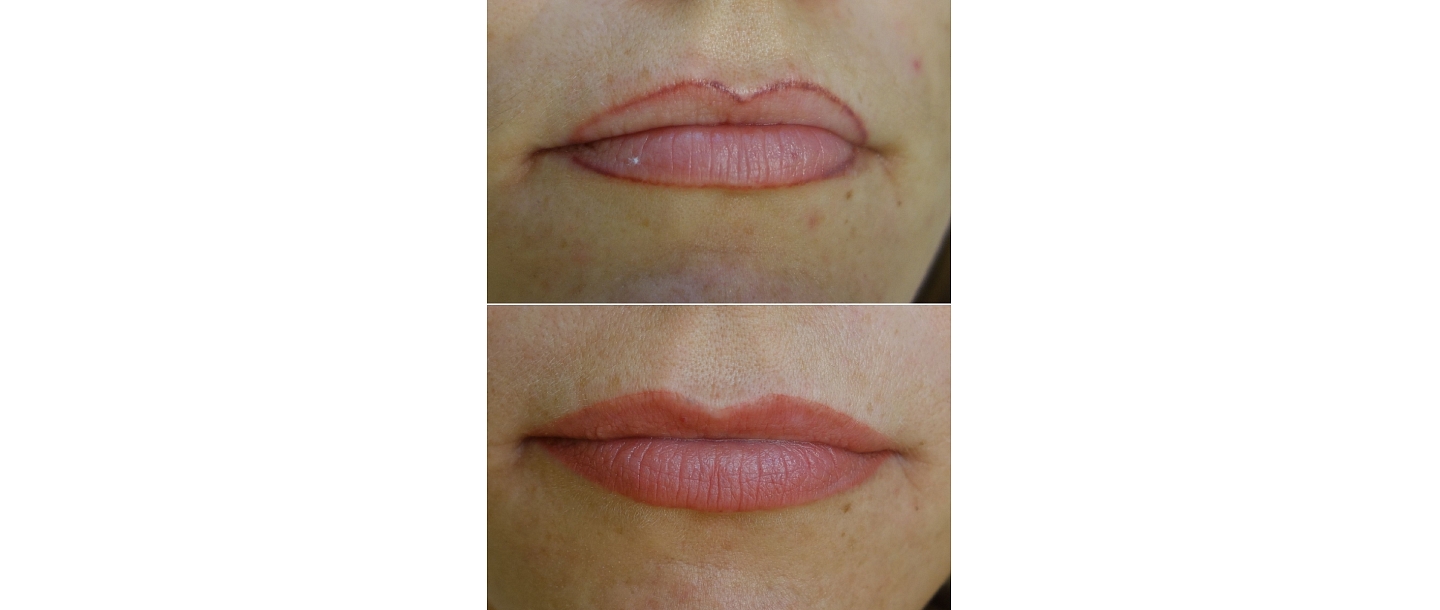 Micropigmentation center