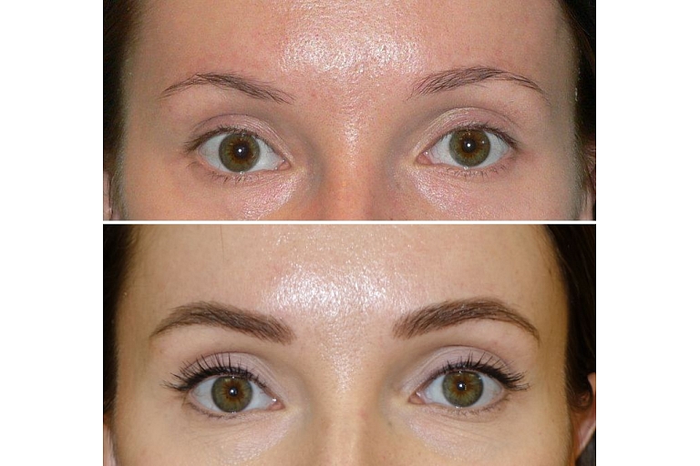 Micropigmentation center