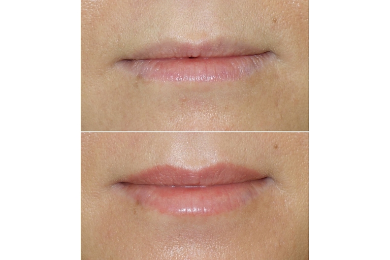 Micropigmentation center