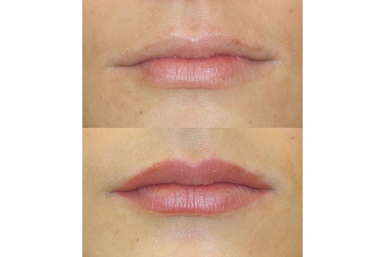 Micropigmentation center