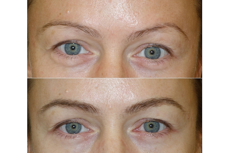 Micropigmentation center