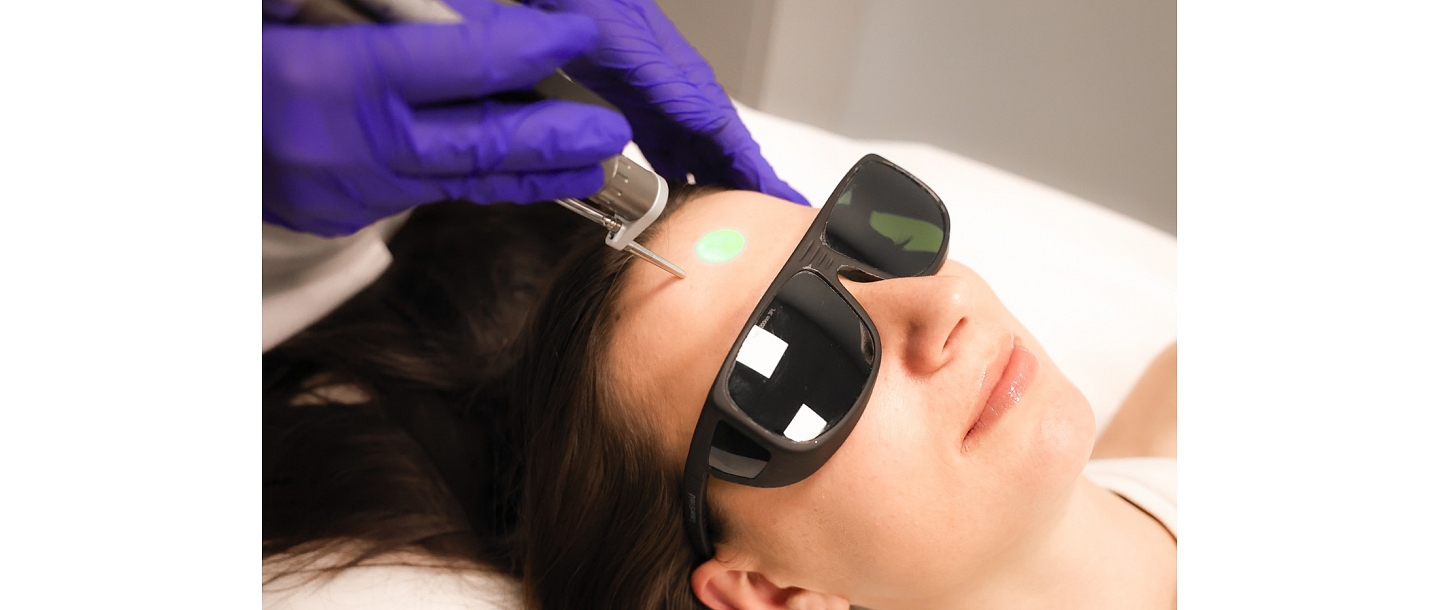 Процедура лазерной эпиляции