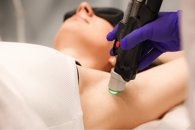 Laser hair removal procedures in Riga