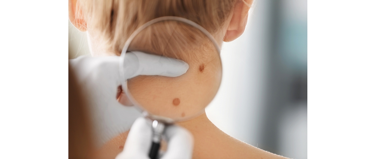 Dermatologist consultations