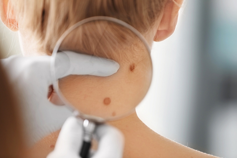 Dermatologist consultations