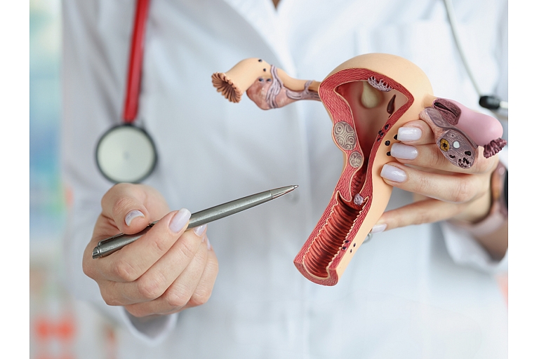 A clear and understandable explanation of the female reproductive system, health changes and treatment options, promoting patient understanding and participation in the treatment process.