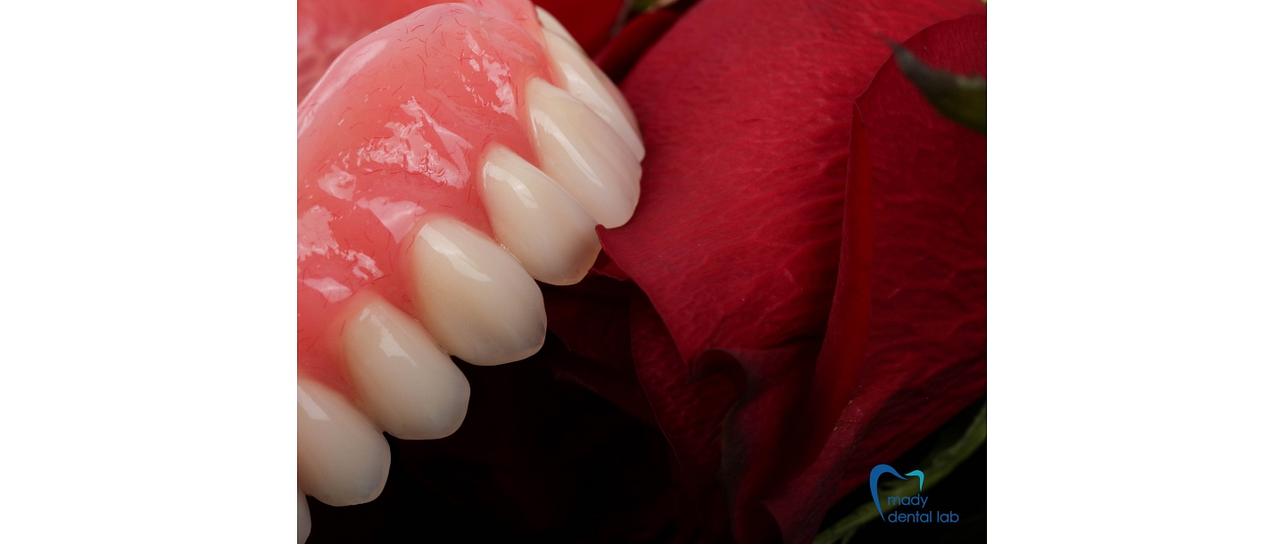 Съемные пластиковые протезы и их репертуар