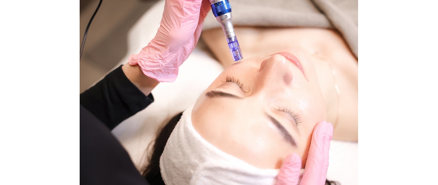 Alexandrite laser hair removal