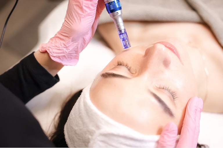 Alexandrite laser hair removal