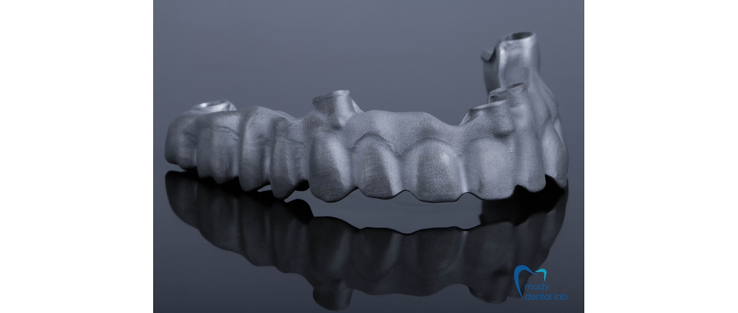 3D-принтированный металлический каркас