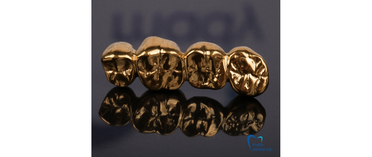 Golden, with gold plating, nitrided crowns