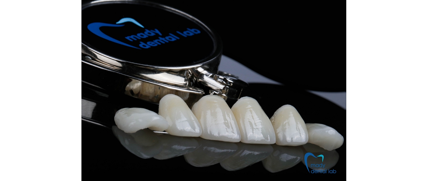 Zirconia crowns