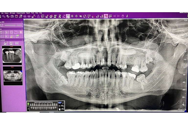 Dentist in Valmiera