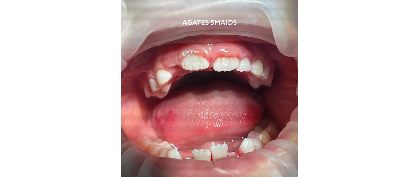 Dental consultations