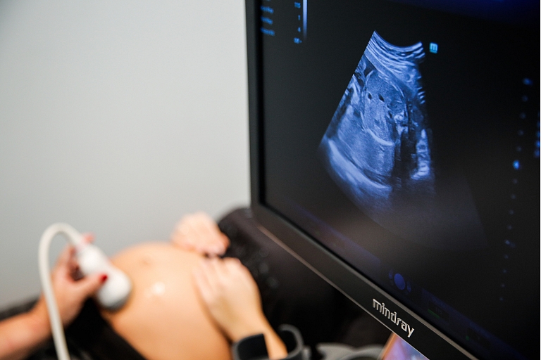 Ультрасонография для беременных