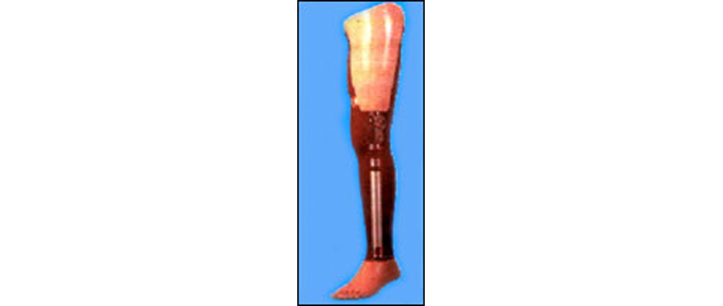 Acceptance by prior appointment - prosthetics
