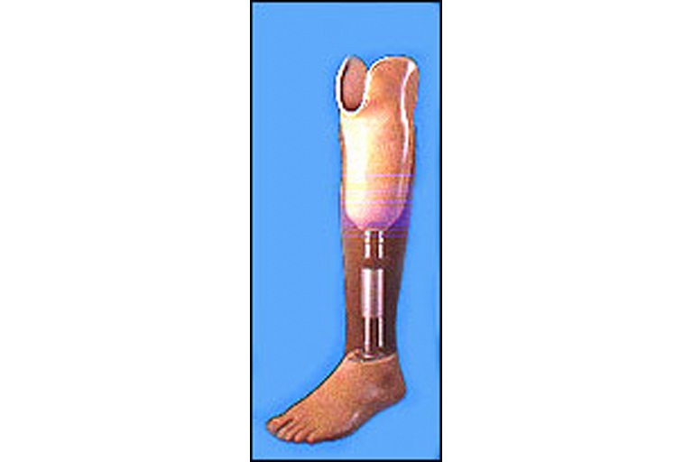Leg prosthesis