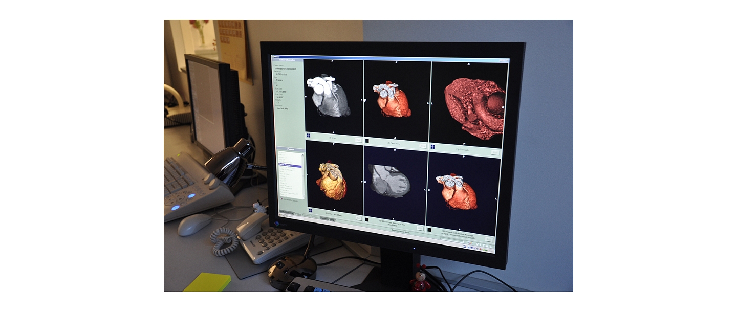 Диагностика