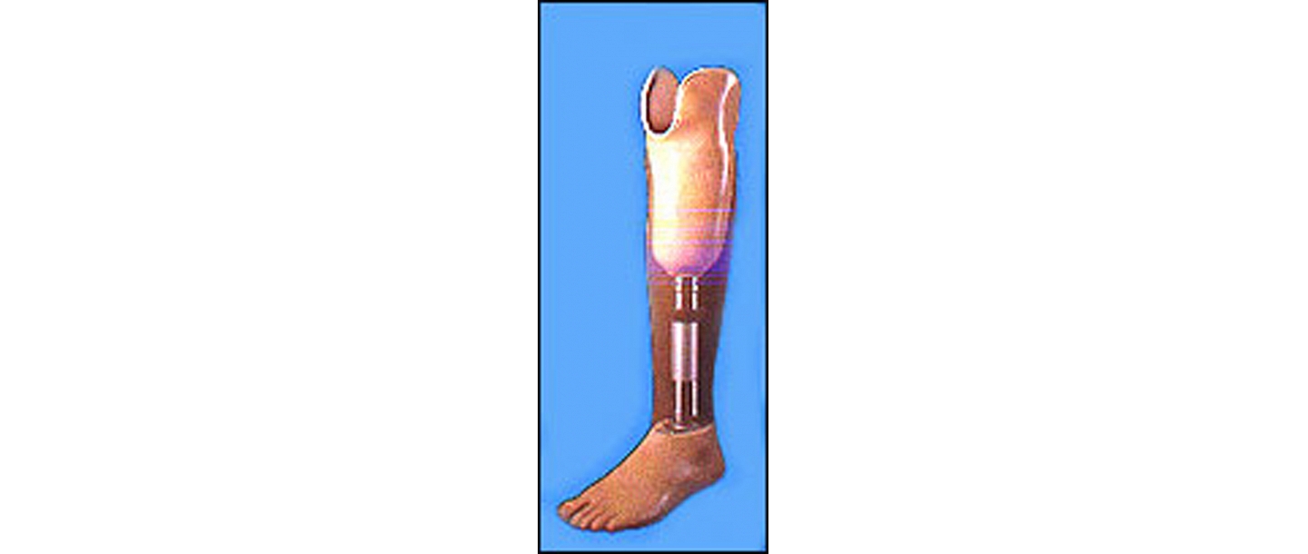 Leg prosthesis