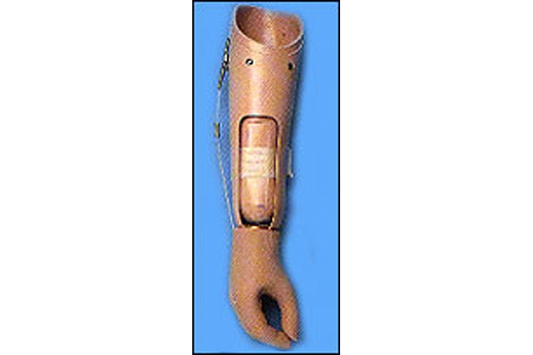 Roku protēze