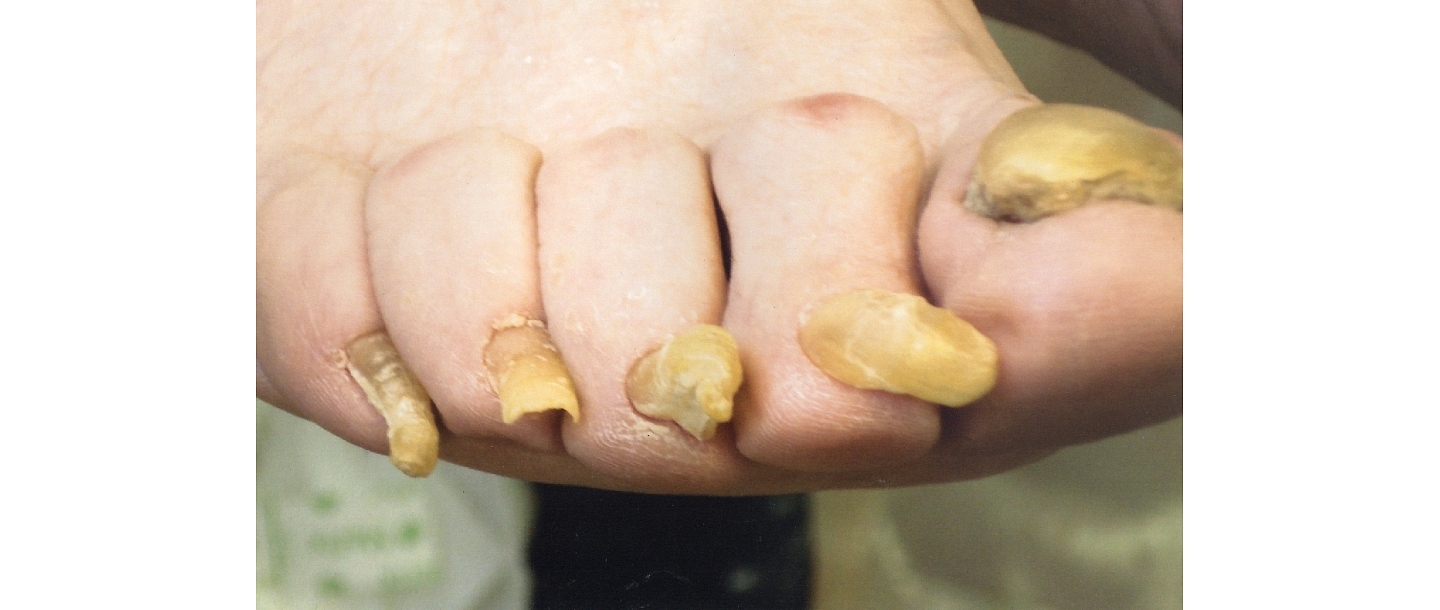 Podiatrist in Jēkabpils region