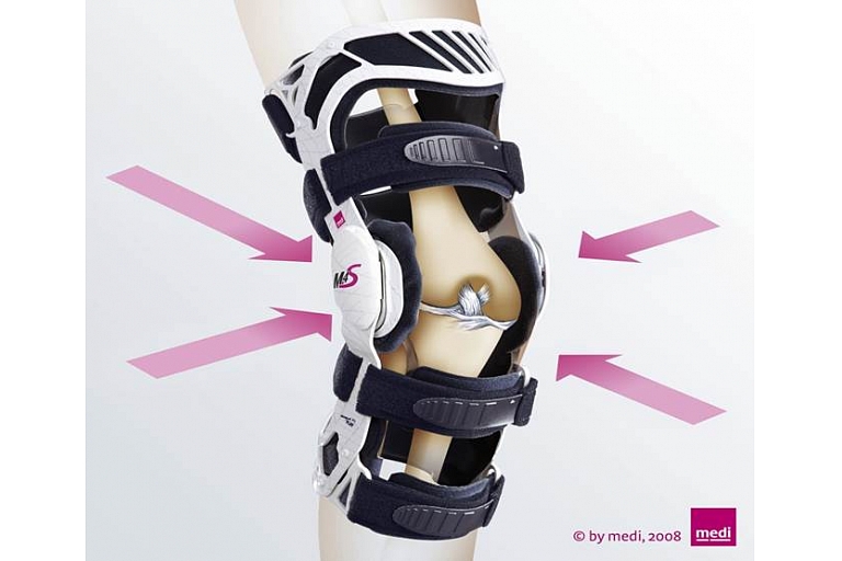 Knee orthosis for stabilization of collateral ligaments