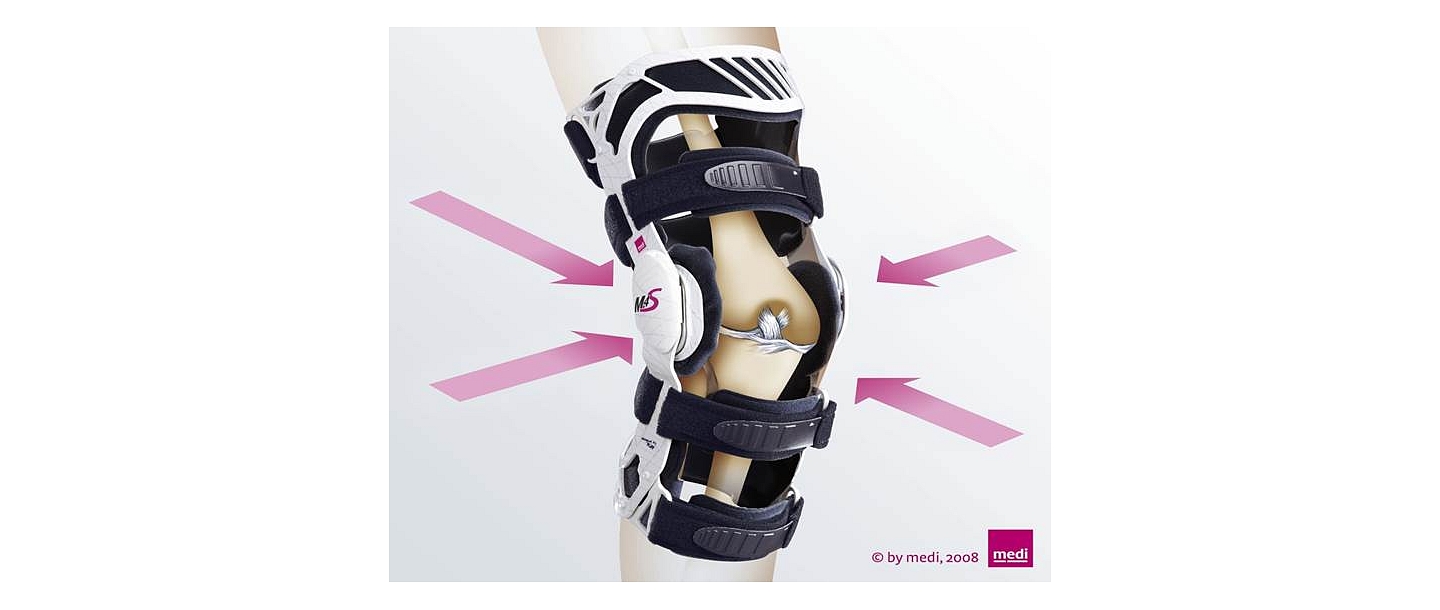 Knee orthosis for stabilization of collateral ligaments