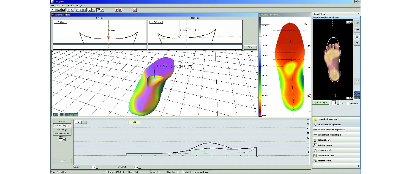 Individually modeled insoles