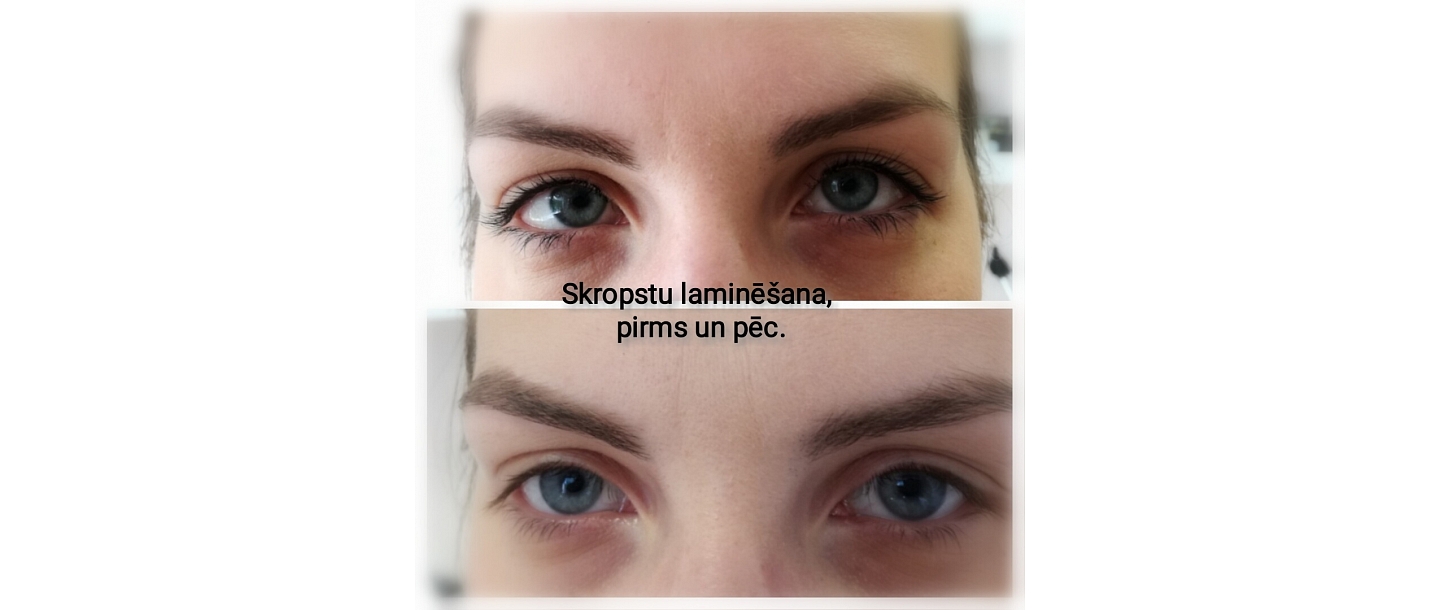 skropstu laminēšana