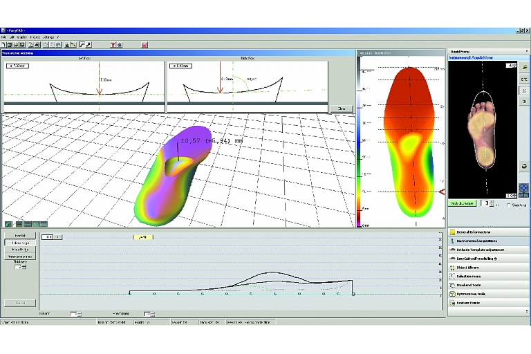 Individually modeled insoles
