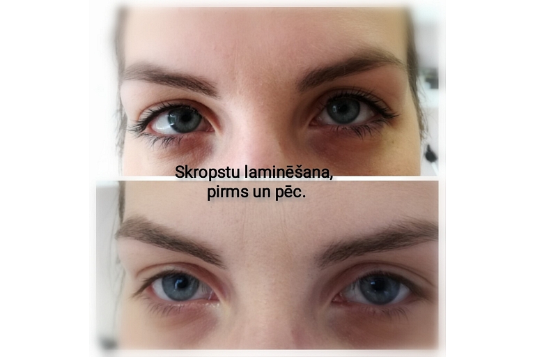 skropstu laminēšana