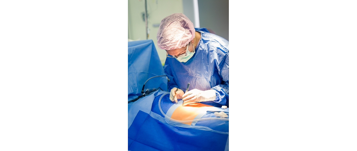 Gynaecological surgeries