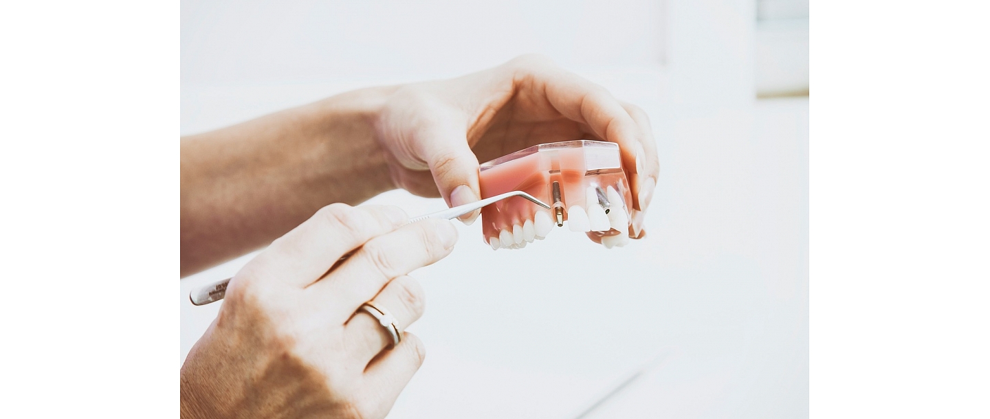 Зубной техник Рудите Лиелмане