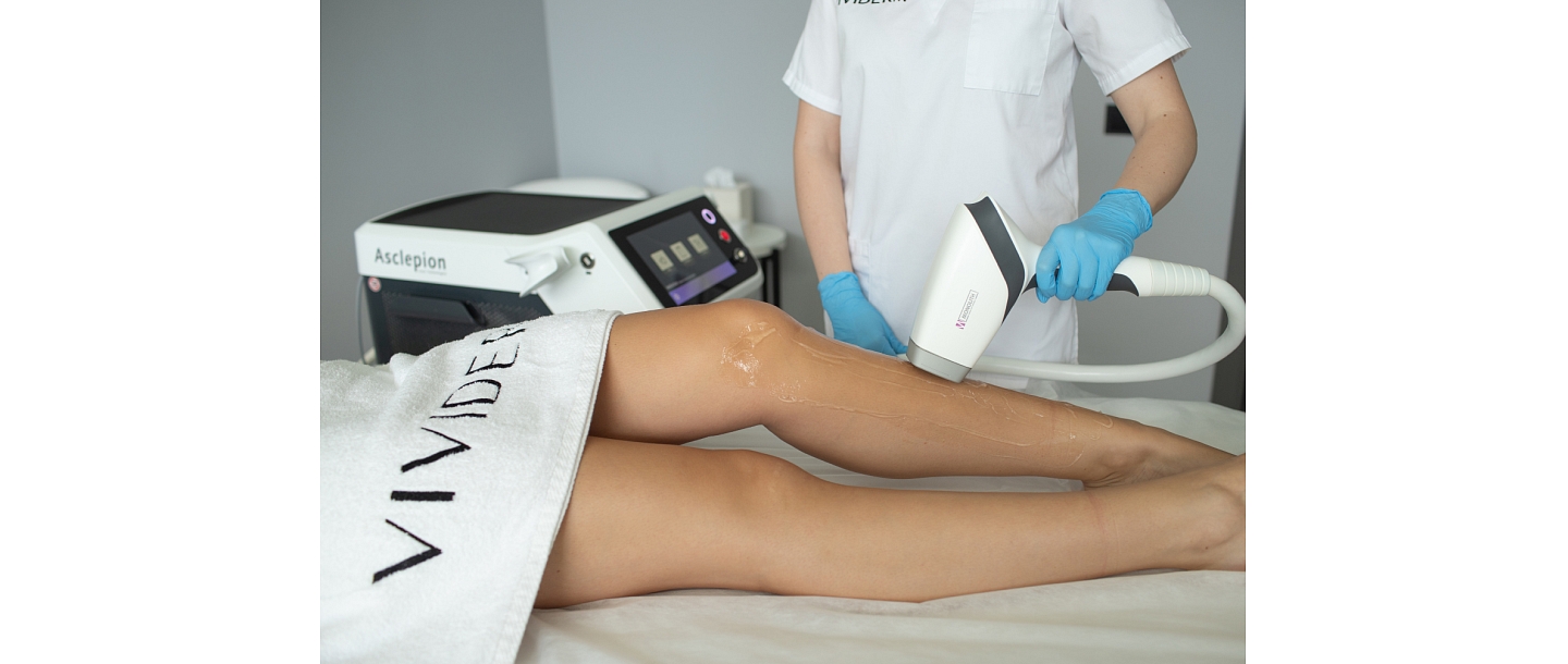 Diode laser hair removal