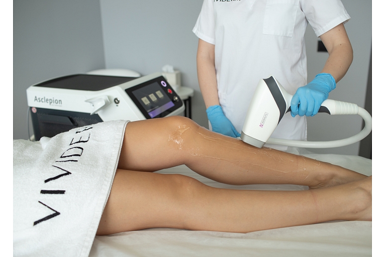 Diode laser hair removal