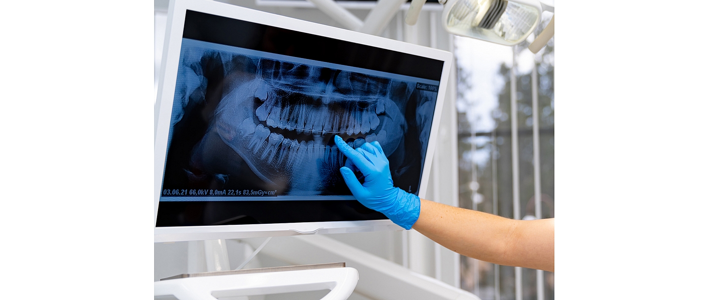 Zobārstniecības prakse Elise NB SIA Liepājā piedāvā mūsdienīgas ārstēšanas metodes, kas atbilst visām kvalitātes prasībām.